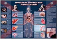Электрифицированный стенд "Вредные привычки: алкоголизм" - «globural.ru» - Ангарск