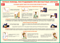 Таблица Порядок действий при опасном кровотечении 1000*1400 винил - «globural.ru» - Ангарск