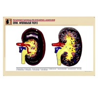 Рельефная таблица "Почка. Фронтальный разрез" (формат А1, матовое ламинир.) - «globural.ru» - Ангарск
